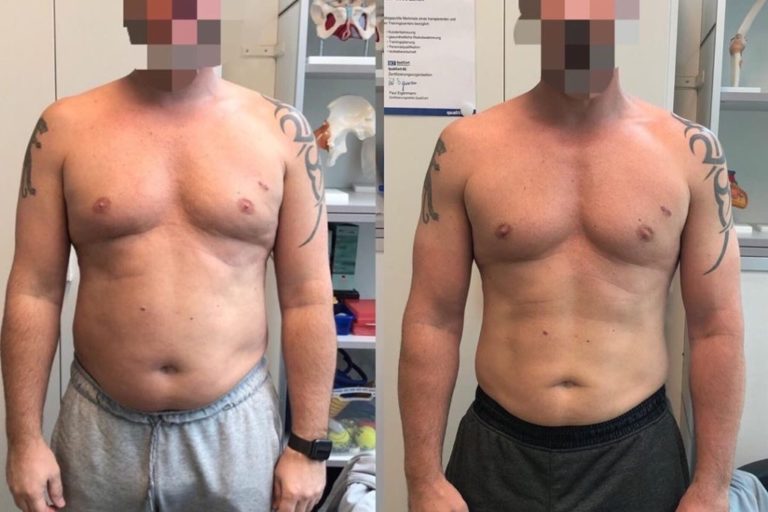 Body Transformation – So schaffst du die Komplettveränderung deines Körpers